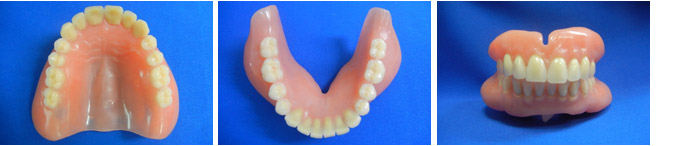 【上下顎同時印象法による総入れ歯】